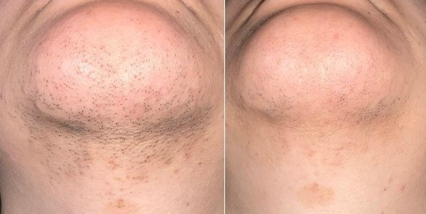 Testimonio de Mariela