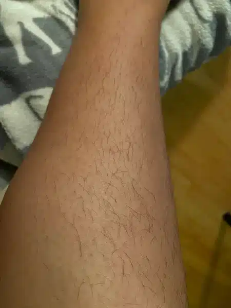 Testimonio de Sofía