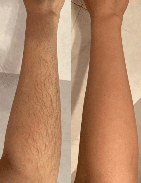 Testimonio de Sofía